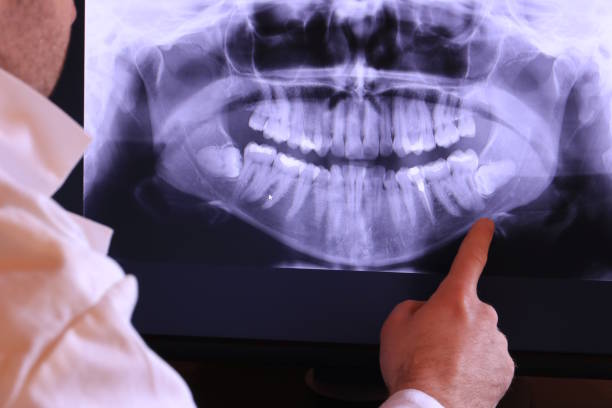 Best Emergency Treatment for Dental Infections or Abscesses in Chase, PA