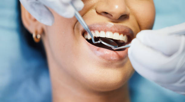Best Emergency Dental Care for Broken or Chipped Teeth in Chase, PA